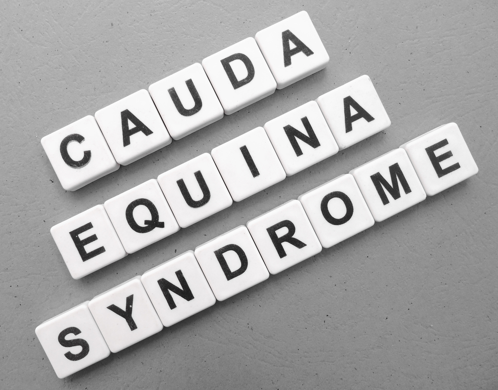 Baltimore Cauda Equina Lawyer