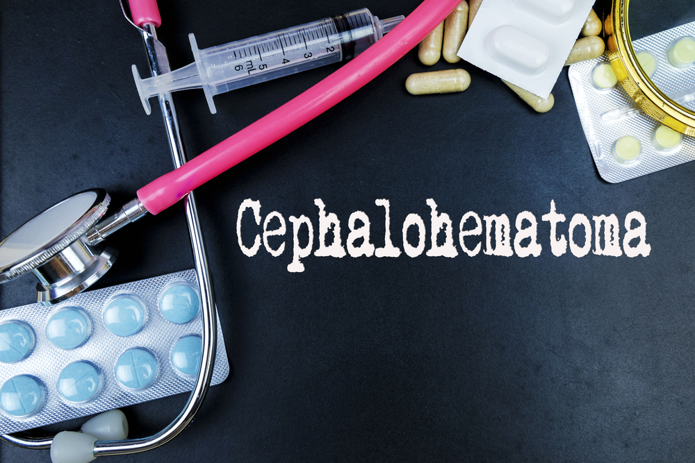 Baltimore Cephalohematoma Lawyer